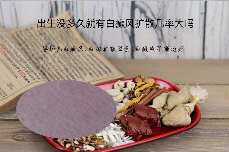 出生没多久就有白癜风扩散几率大吗”