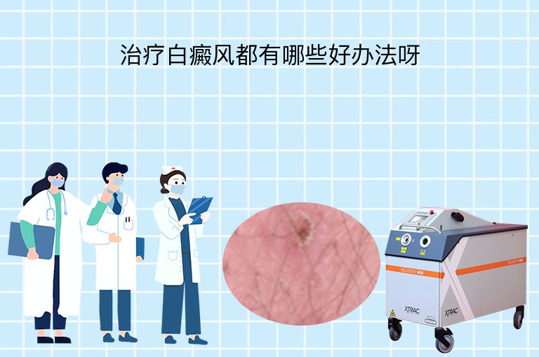 治疗白癜风都有哪些好办法呀”