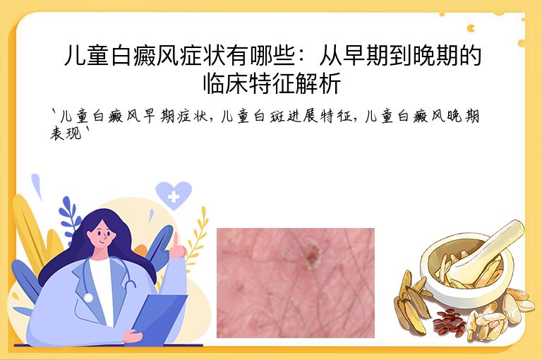 儿童白癜风症状有哪些:从早期到晚期的临床特征解析