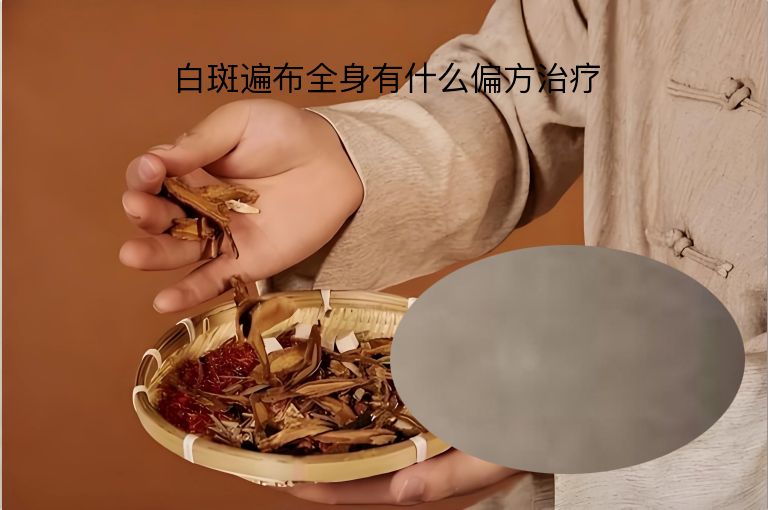 白斑遍布全身有什么偏方治疗”