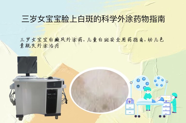 三岁女宝宝脸上白斑的科学外涂药物指南”