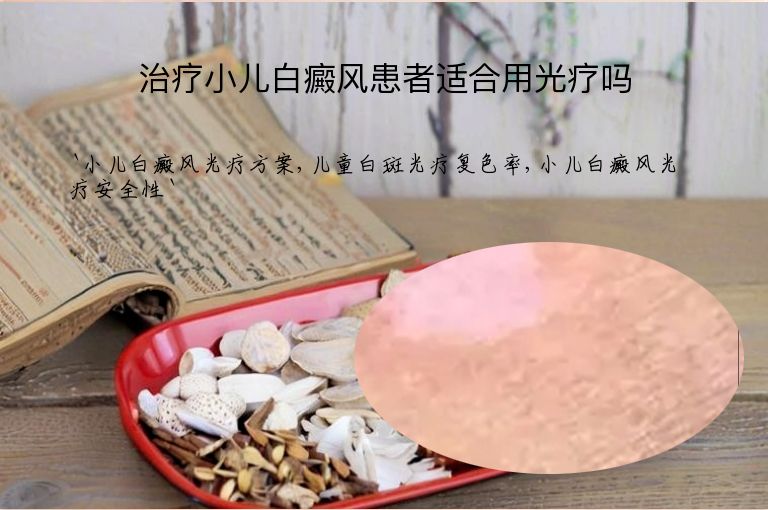 治疗小儿白癜风患者适合用光疗吗