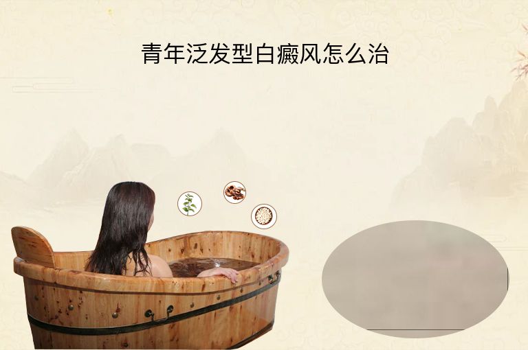 青年泛发型白癜风怎么治”