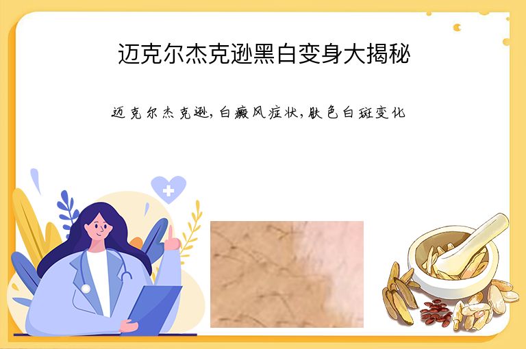 迈克尔杰克逊黑白变身大揭秘”