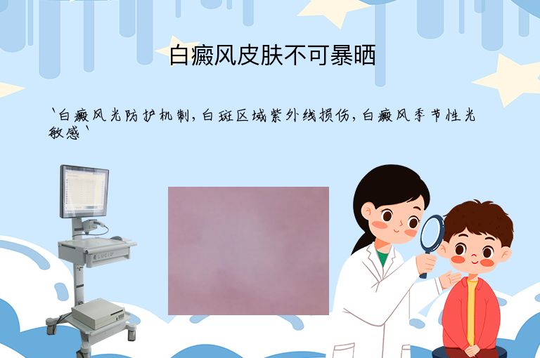 白癜风皮肤不可暴晒