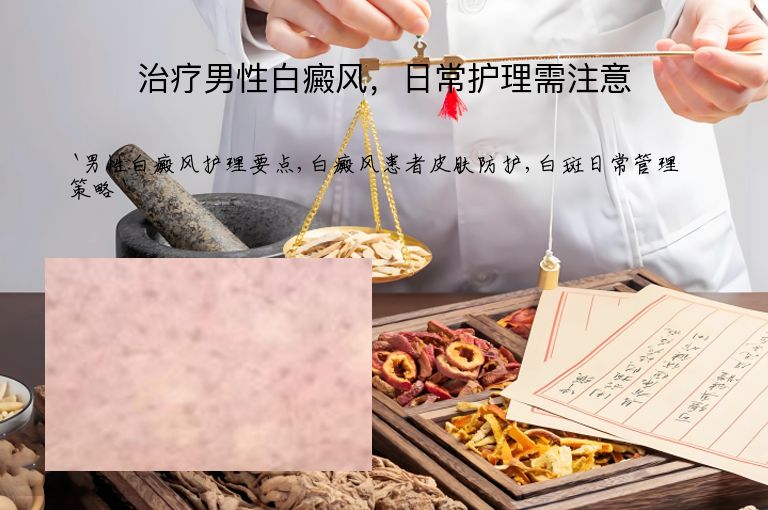 治疗男性白癜风，日常护理需注意