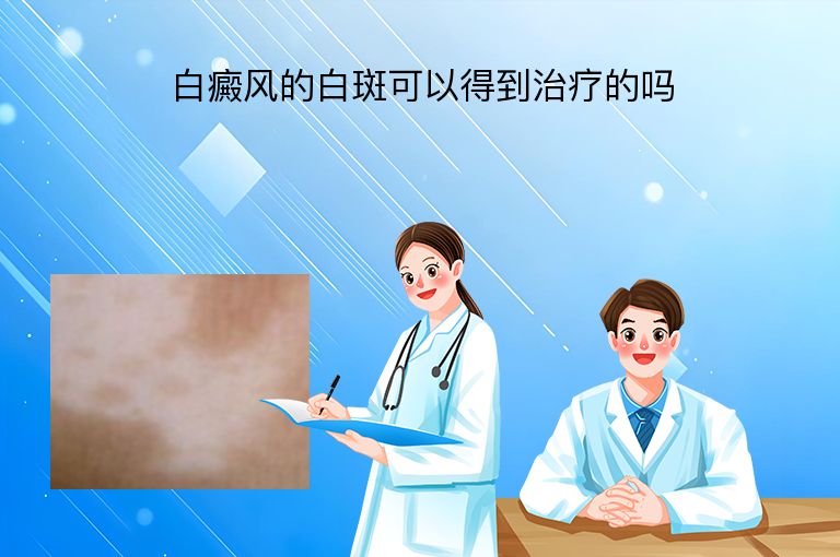 白癜风的白斑可以得到治疗的吗”