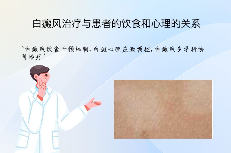 白癜风治疗与患者的饮食和心理的关系”