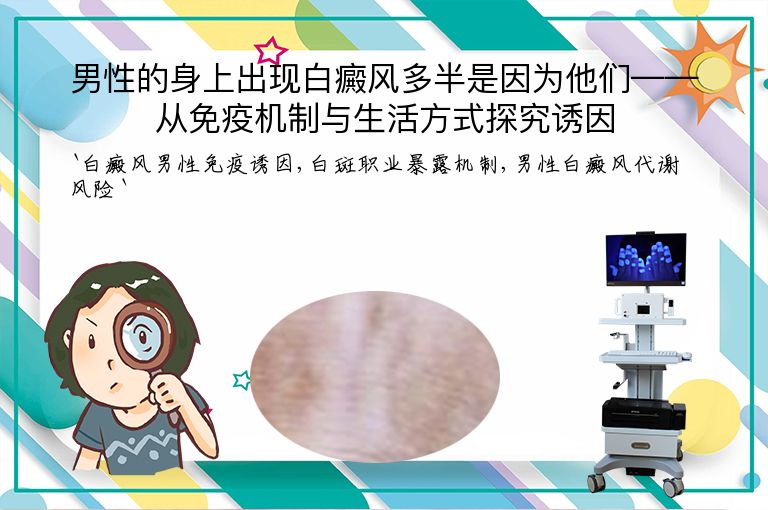 男性的身上出现白癜风多半是因为他们——从免疫机制与生活方式探究诱因