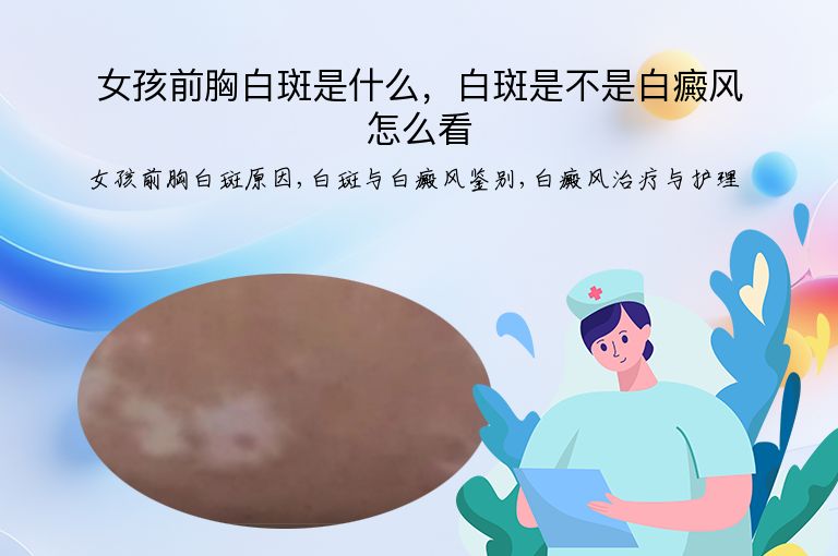 女孩前胸白斑是什么，白斑是不是白癜风怎么看”
