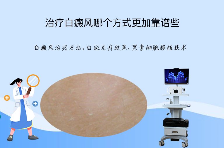治疗白癜风哪个方式更加靠谱些”