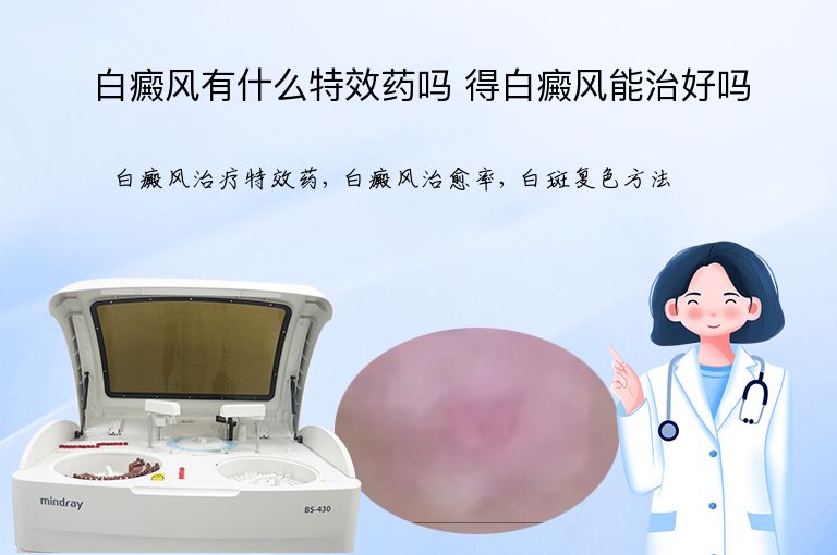 白癜风有什么特效药吗 得白癜风能治好吗”