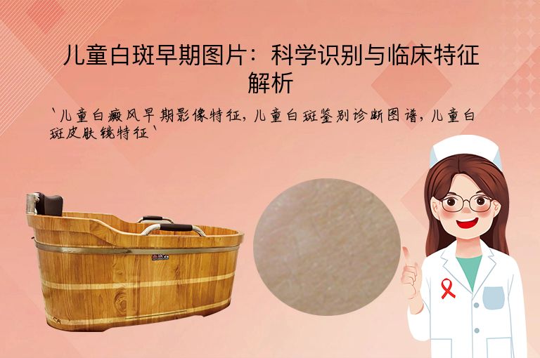 儿童白斑早期图片:科学识别与临床特征解析