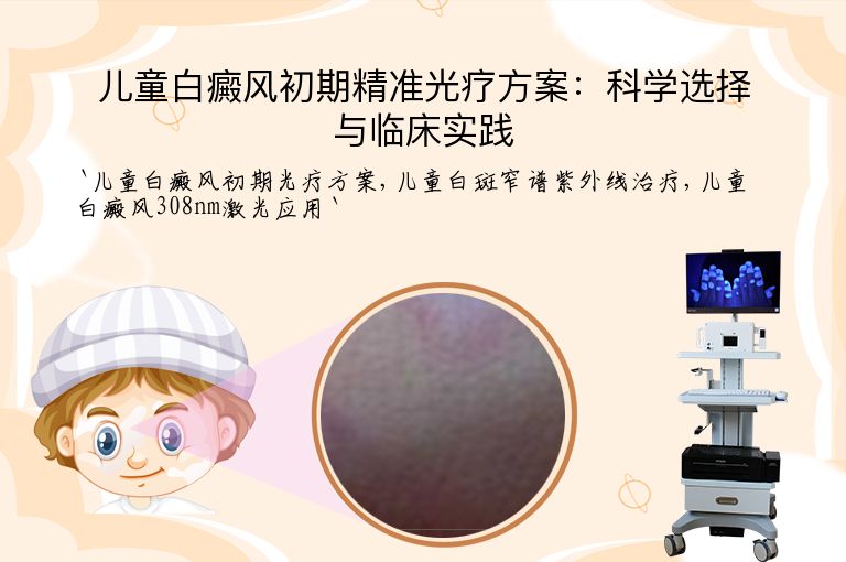 儿童白癜风初期精准光疗方案：科学选择与临床实践”