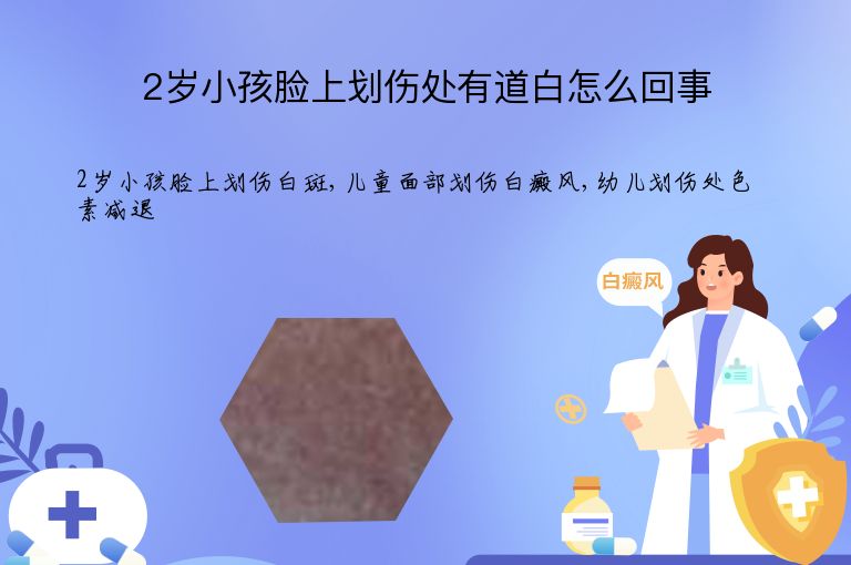 https://www.bdfsjzyy.com/d/file/p/36d9f897bc02330bfca59a001256d762.jpeg