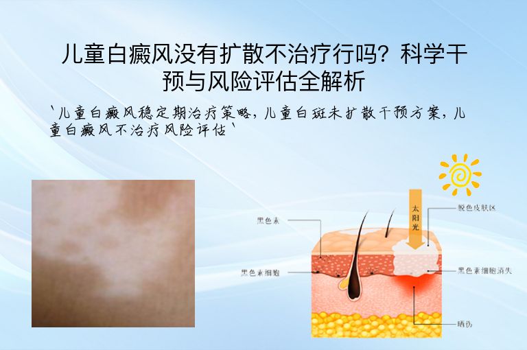 儿童白癜风没有扩散不治疗行吗?科学干预与风险评估全解析