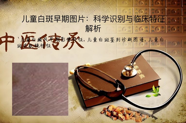 儿童白斑早期图片:科学识别与临床特征解析