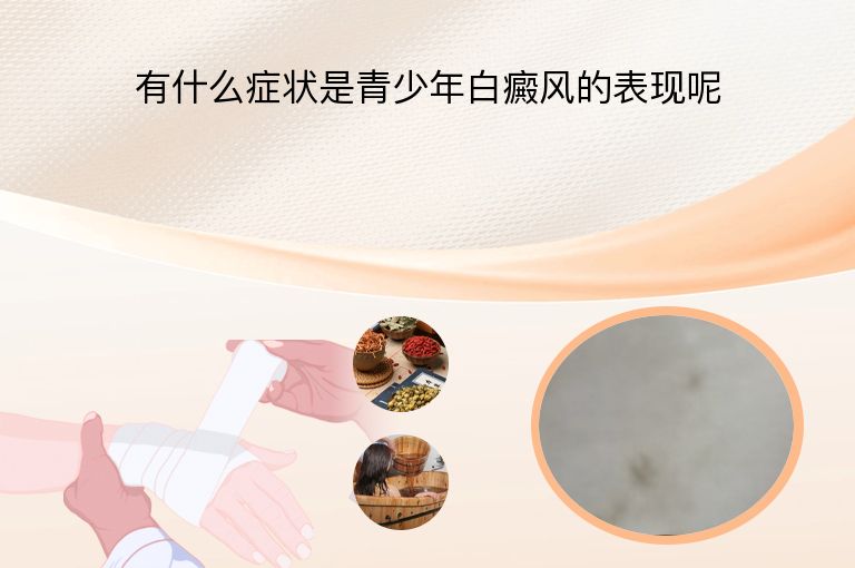 有什么症状是青少年白癜风的表现呢