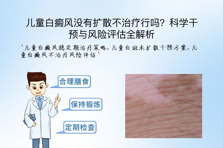 儿童白癜风没有扩散不治疗行吗?科学干预与风险评估全解析