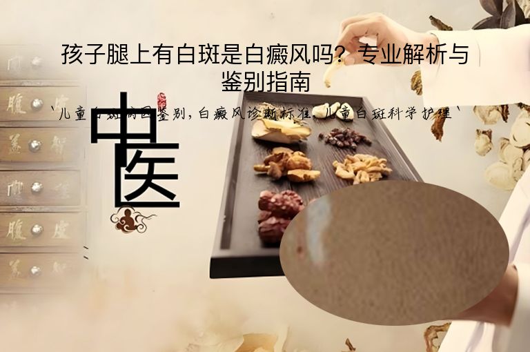 孩子腿上有白斑是白癜风吗？专业解析与鉴别指南”