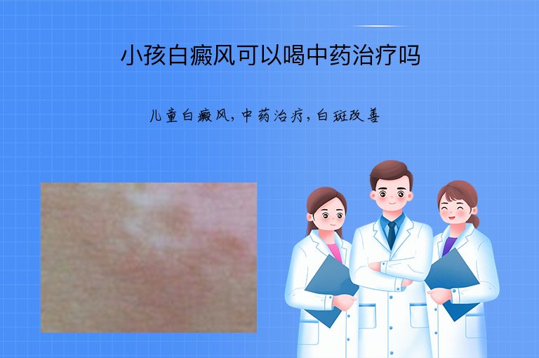 小孩白癜风可以喝中药治疗吗”