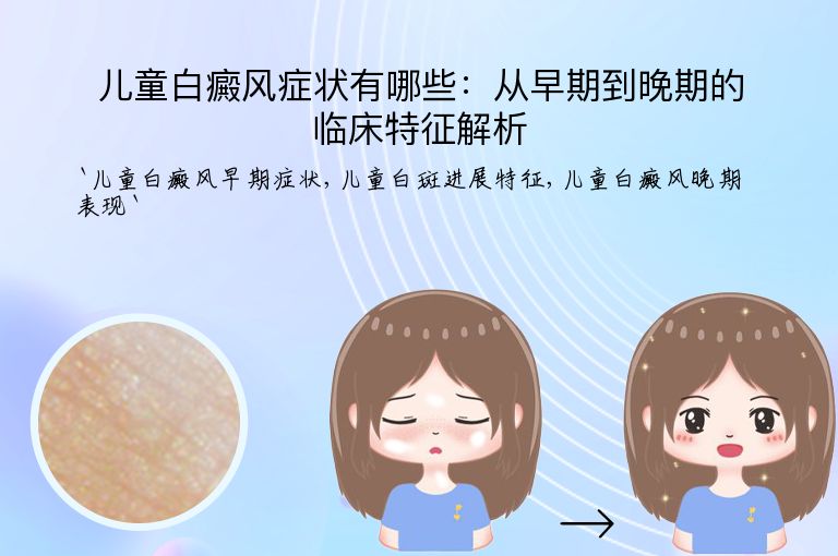 儿童白癜风症状有哪些:从早期到晚期的临床特征解析