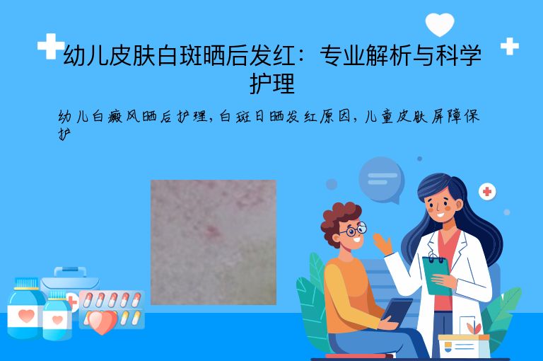 幼儿皮肤白斑晒后发红：专业解析与科学护理”
