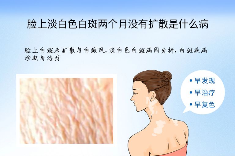 脸上淡白色白斑两个月没有扩散是什么病”