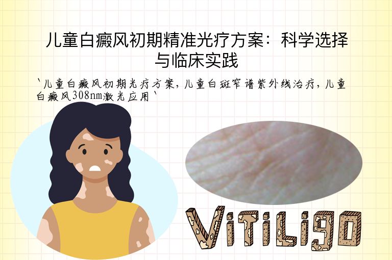 儿童白癜风初期精准光疗方案：科学选择与临床实践