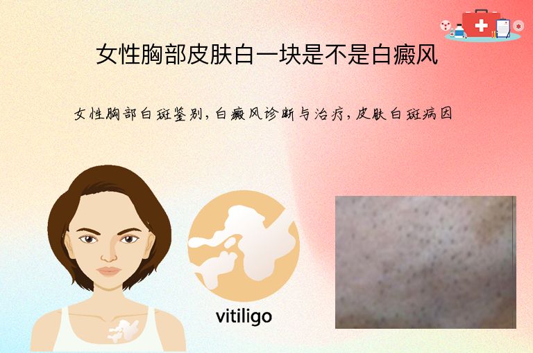 https://www.bdfsjzyy.com/d/file/p/c120420af45caef36efdd485b634e784.jpeg