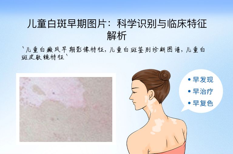 儿童白斑早期图片：科学识别与临床特征解析