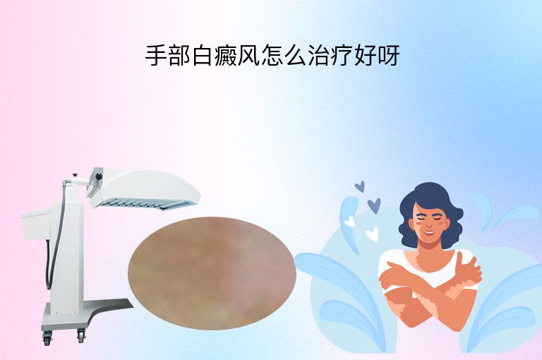 手部白癜风怎么治疗好呀”