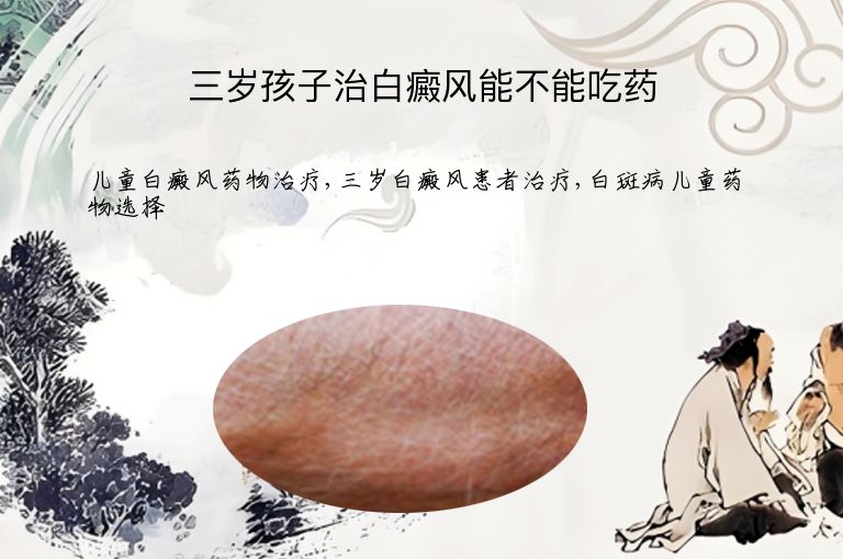 三岁孩子治白癜风能不能吃药”