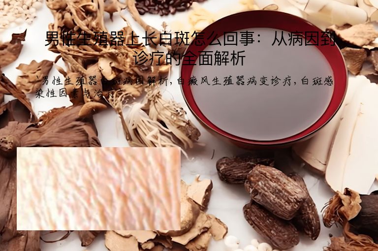 男性生殖器上长白斑怎么回事:从病因到诊疗的全面解析