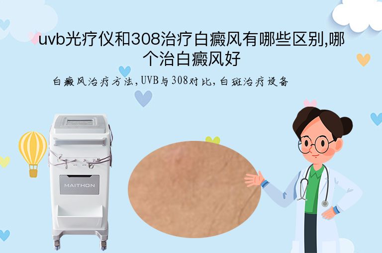 uvb光疗仪和308治疗白癜风有哪些区别,哪个治白癜风好”