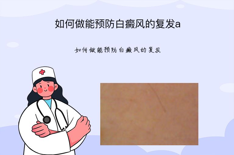 如何做能预防白癜风的复发a”