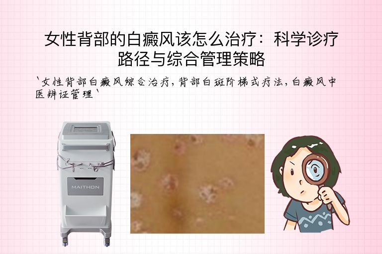 女性背部的白癜风该怎么治疗:科学诊疗路径与综合管理策略