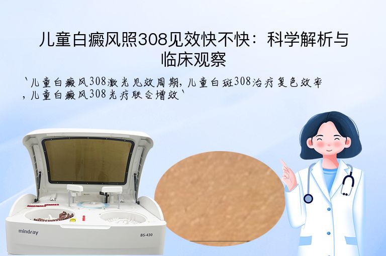 儿童白癜风照308见效快不快:科学解析与临床观察