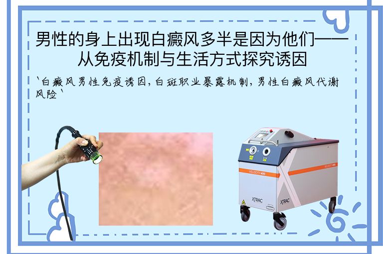 男性的身上出现白癜风多半是因为他们——从免疫机制与生活方式探究诱因