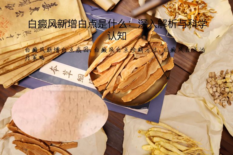 白癜风新增白点是什么：深入解析与科学认知”