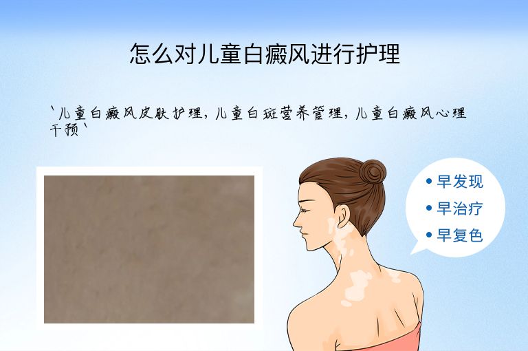 怎么对儿童白癜风进行护理”