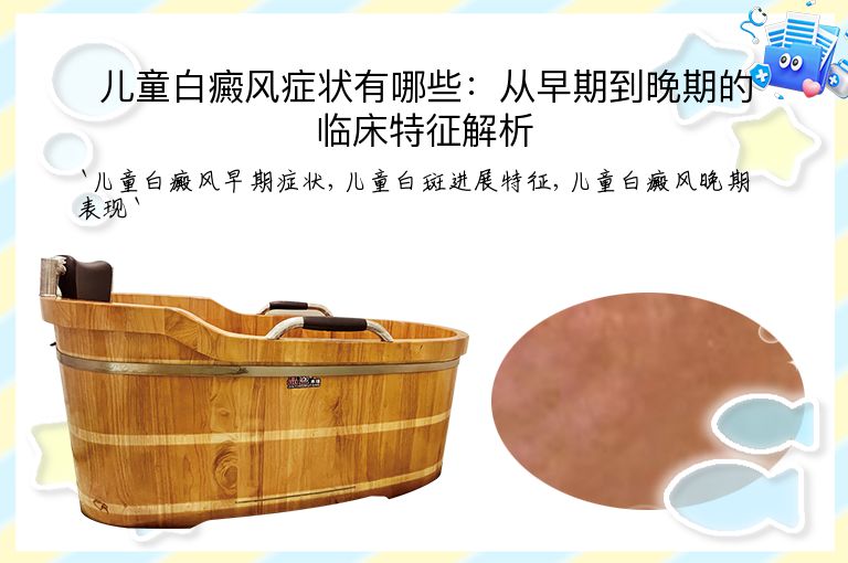 儿童白癜风症状有哪些:从早期到晚期的临床特征解析