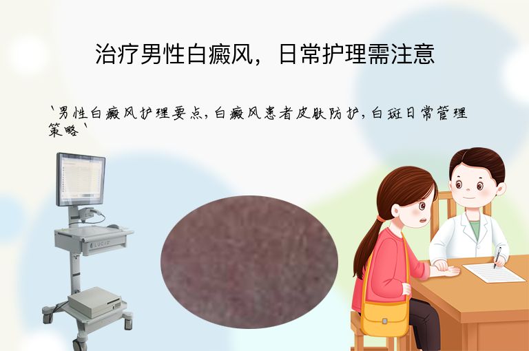 治疗男性白癜风,日常护理需注意