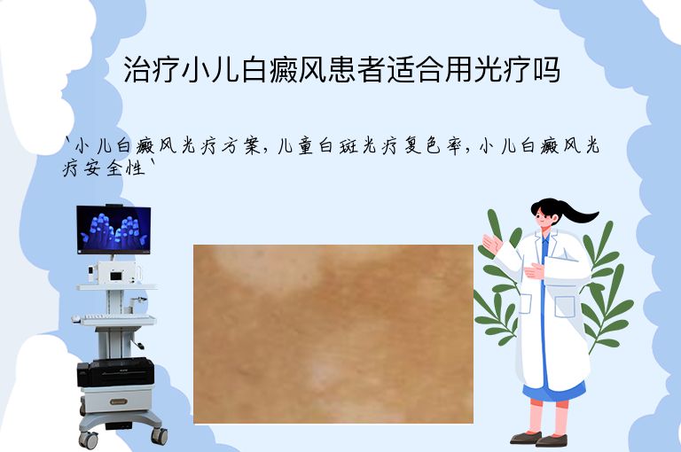 治疗小儿白癜风患者适合用光疗吗