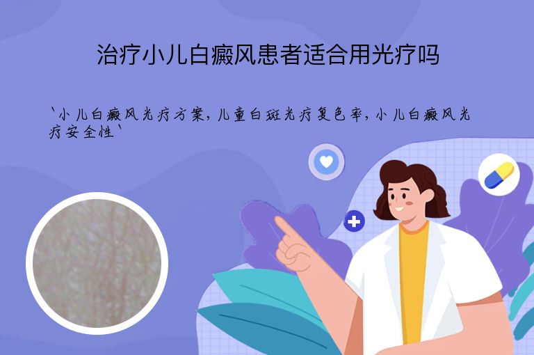 治疗小儿白癜风患者适合用光疗吗