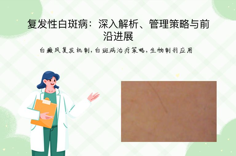 复发性白斑病:深入解析、管理策略与前沿进展”