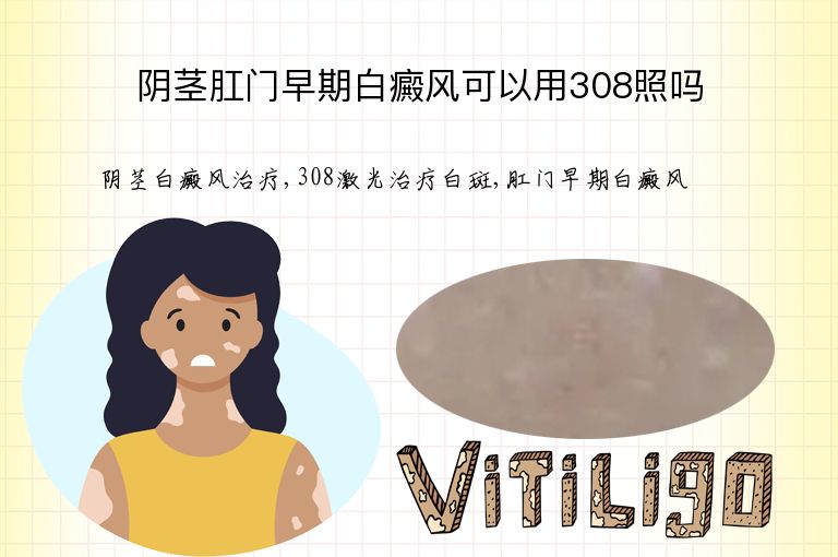 阴茎肛门早期白癜风可以用308照吗”