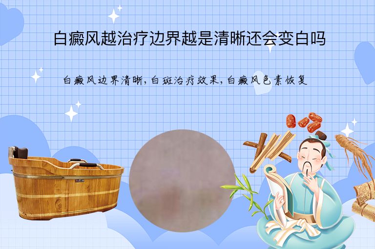 白癜风越治疗边界越是清晰还会变白吗”