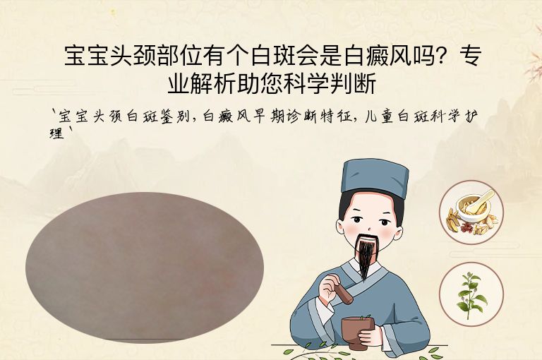 宝宝头颈部位有个白斑会是白癜风吗？专业解析助您科学判断”