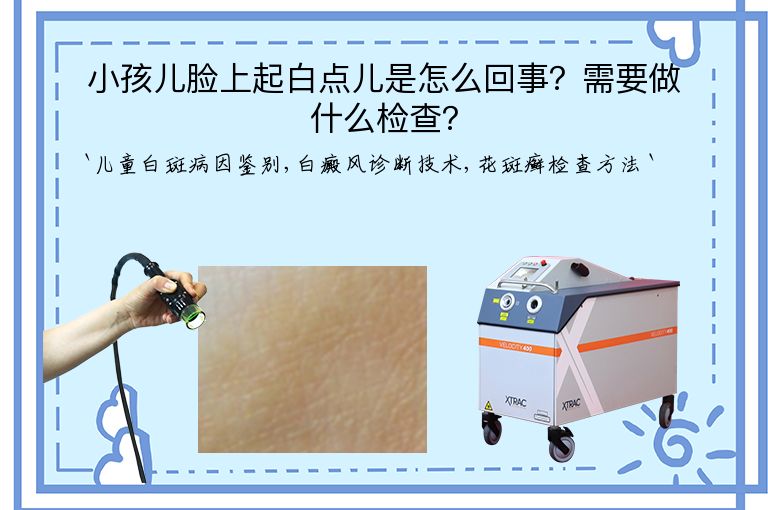 小孩儿脸上起白点儿是怎么回事?需要做什么检查?